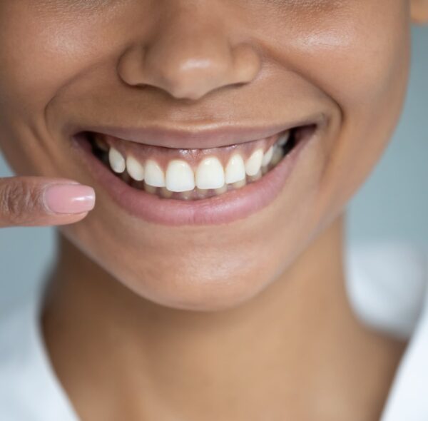 Cómo mantener saludable el esmalte de tus dientes