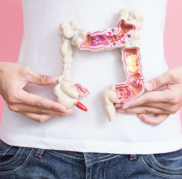 Cáncer Colorrectal